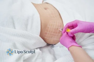 Are The Results From Aqualyx Permanent? 1 Do you want to know how long Aqualyx Princes Risborough results last?